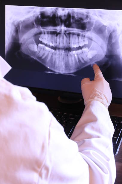 Best Emergency Dental Care for Broken or Chipped Teeth in San Dimas, CA